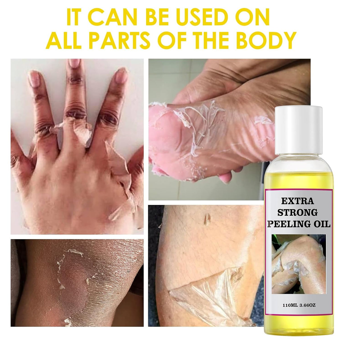 Yellow Peeling Oil for Dark Skin Strong Peel Oil Extra Strength Exfoliating Chemical Exfoliant Peels Solution at Home Body Peeling for Exfoliate Body Hand Foot Knuckle All Skin Type 3.66 OZ