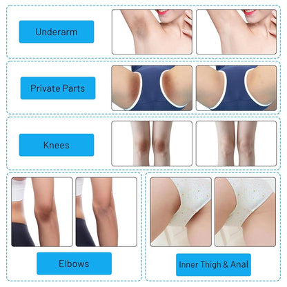 Skin Whitening Cream Bleaching Cream for Body Intimate Area, Private Parts, Underarm, Knees, Elbows, Inner Thigh, Bikini Areas, Bikini Line, Skin Lightening Dark Spot Remover for Intimate Areas 60ML