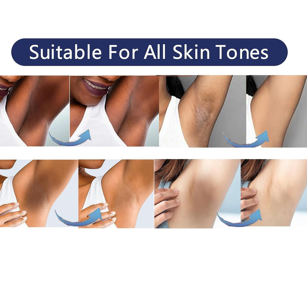 Skin Whitening Cream Bleaching Cream for Body Intimate Area, Private Parts, Underarm, Knees, Elbows, Inner Thigh, Bikini Areas, Bikini Line, Skin Lightening Dark Spot Remover for Intimate Areas 60ML